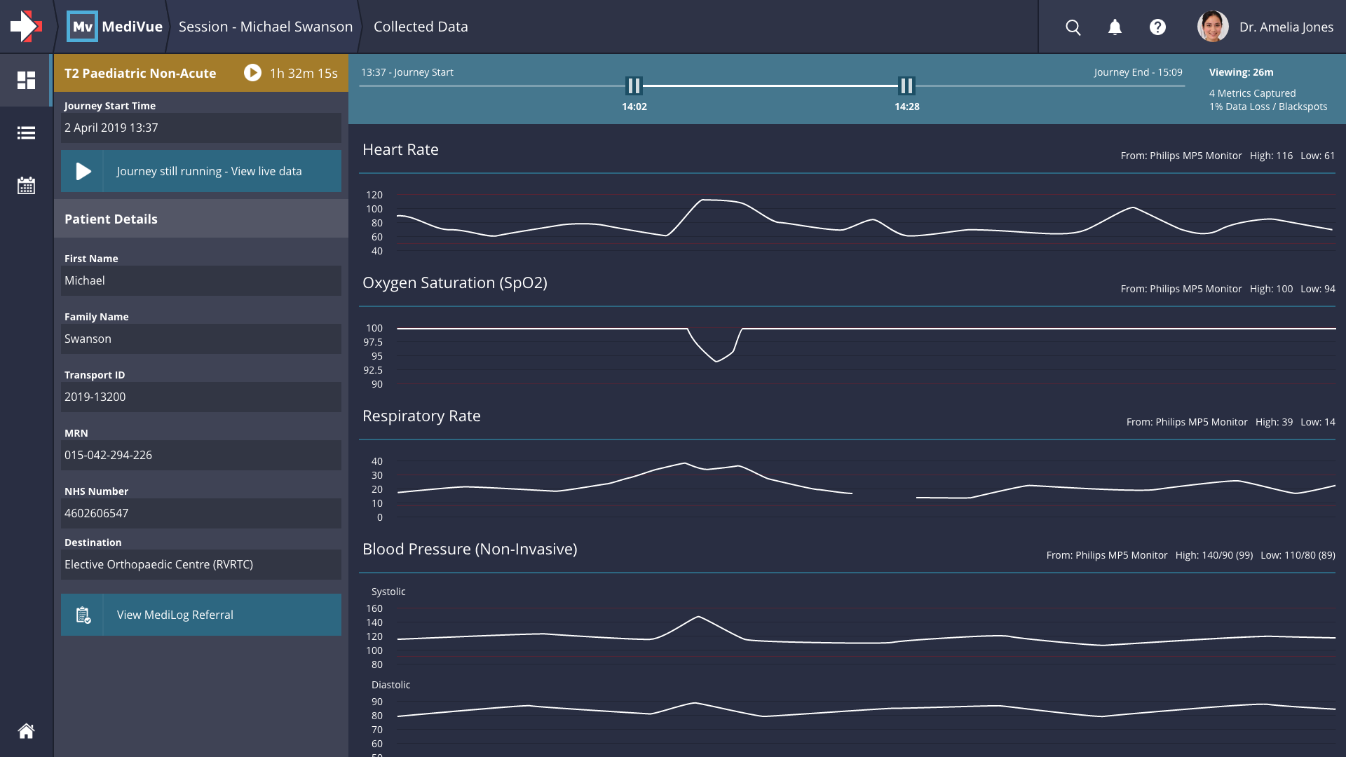 MediVue A screenshot of MediVue showing historic trend data for a patient